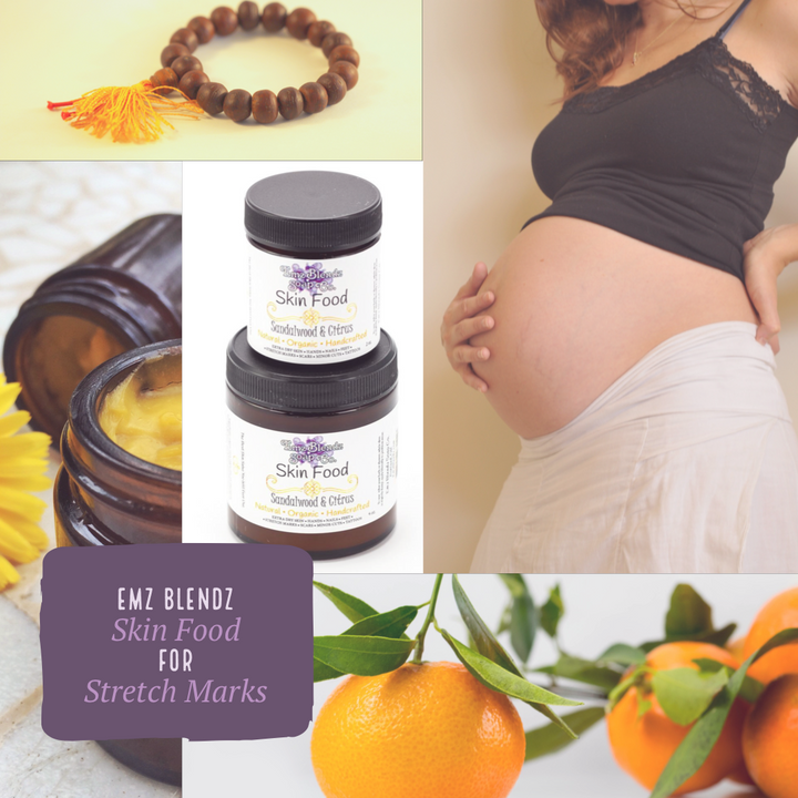 Skin Food Remedy (Sandalwood Citrus) | Stretch Mark & Scar Defense    Em'z Blendz Soap Co.